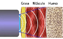 Imagen esquemática de capas de la piel siendo incididas por terapia de Bioimpedancia