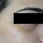 Caso 11. Final . Imagen de rostro donde se aprecia la piel sana