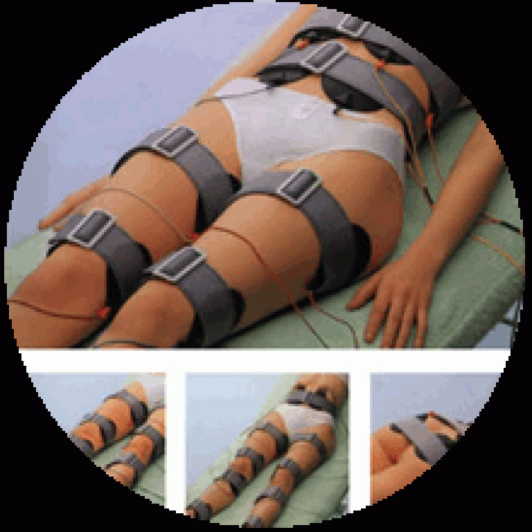 Paciente acostada sobre camilla con equipo de electroterapia recibiendo tratamiento