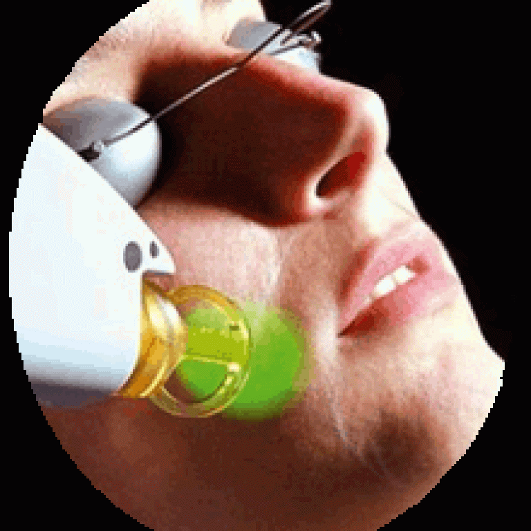 El Dr. Hombre está aplicando el láser en la mejilla de la paciente. El dispositivo emite un haz de luz roja o azul, dependiendo del tipo de terapia. La piel de la paciente refleja suavemente la luz, dando un efecto futurista y profesional.